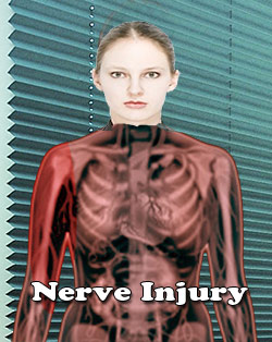 Neurotmesis : Nerve Injury